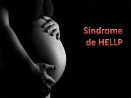 Sindrom hellp.jpg