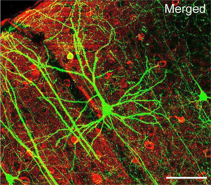 Archivo:Circuito de neurona.jpg