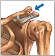 Lesión de articulación.jpg