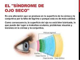 Sindrome de ojo seco .jpg