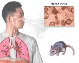 Hanta-virus.jpg