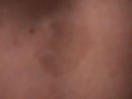 MANCHAS OSCURAS EN LA PIEL.jpeg