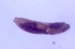 Stephanostomum coryphaenae.jpg