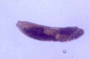 Stephanostomum coryphaenae.jpg