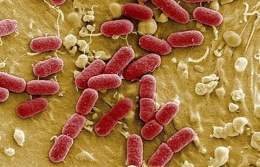 E-coli-enterohemorragica.jpg