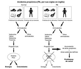 Acidemia propiónica1.jpg