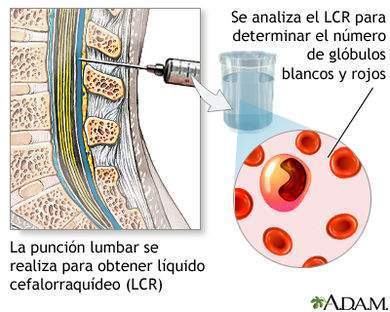 Conteo de células en LCR - EcuRed