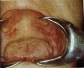 Ampollosa1.JPG