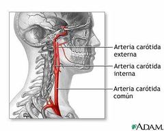 Arterias Carótidas.jpg