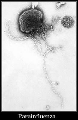 Parainfluenza.jpg
