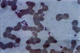 Bartonella bacilliformis.jpeg
