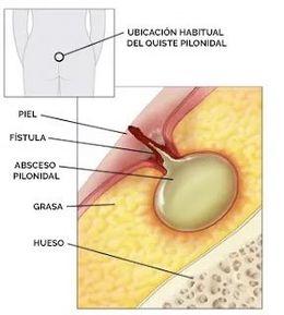 Glúteos - EcuRed