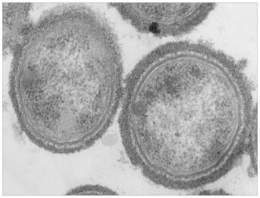 Actinobacillus - EcuRed