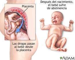Abstinencia neonatal.jpg