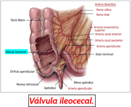 Ileocecal.png