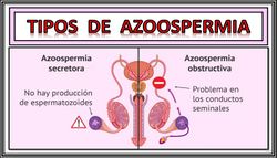 Azoospermia.jpg