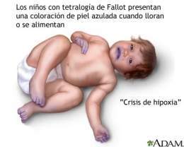 Crisis de hipoxia 1.jpg