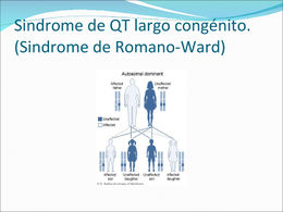 Síndrome de Romano Ward.jpg