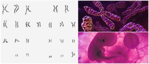 Anomalías cromosómicas.jpg