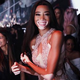 Winnie Harlow.jpg