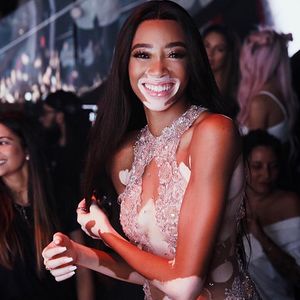 Winnie Harlow.jpg