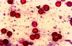 Criptosporidium.jpg