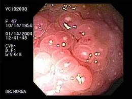 Gastrointestinalatl.jpg