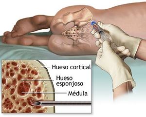 Cultivo de la medula osea.JPG