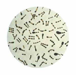 Difteria.jpg
