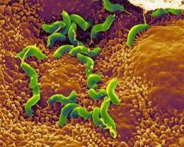 Ahelicobacter 21.jpg