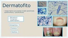 Dermatofitos.jpg
