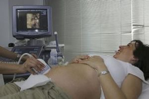 Dia internacional de la obstetricia.jpg