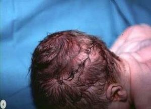 Cabeza.jpg