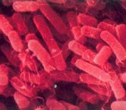 Klebsiella.jpg