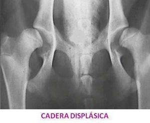 Cadera displásica.jpg