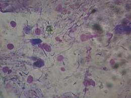 Hemocitos D.balteata.jpg