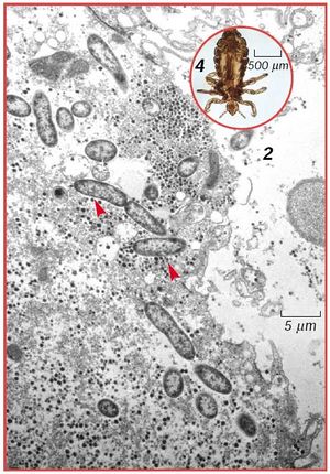 Rickettsia prowazekii.jpg