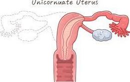 Utero unicorne.jpg