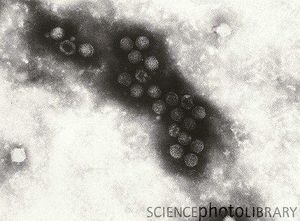 Gumboro viruses-SPL.jpg