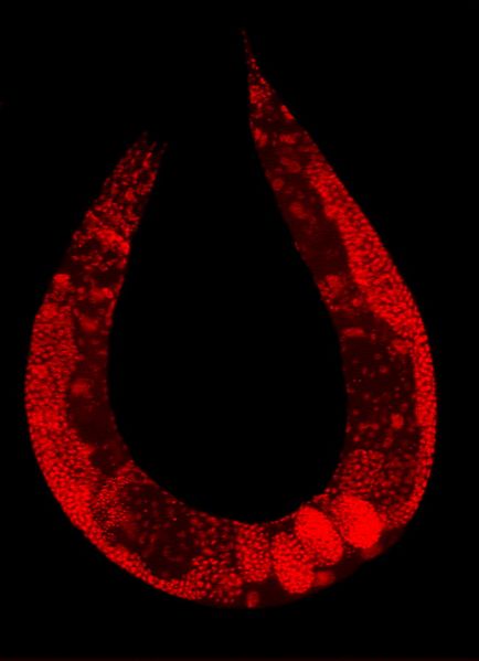 Archivo:C elegans stained.jpg