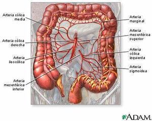 Isquemia de las arterias mesentéricas.jpg