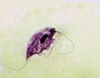 Trichomona foetus.JPG