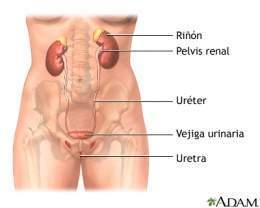 Urop. obst. unilateral crónica .jpg