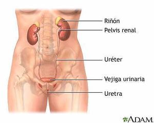 Urop. obst. unilateral crónica .jpg
