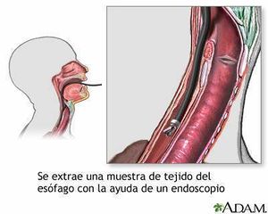 Cultivo esofagico.jpg