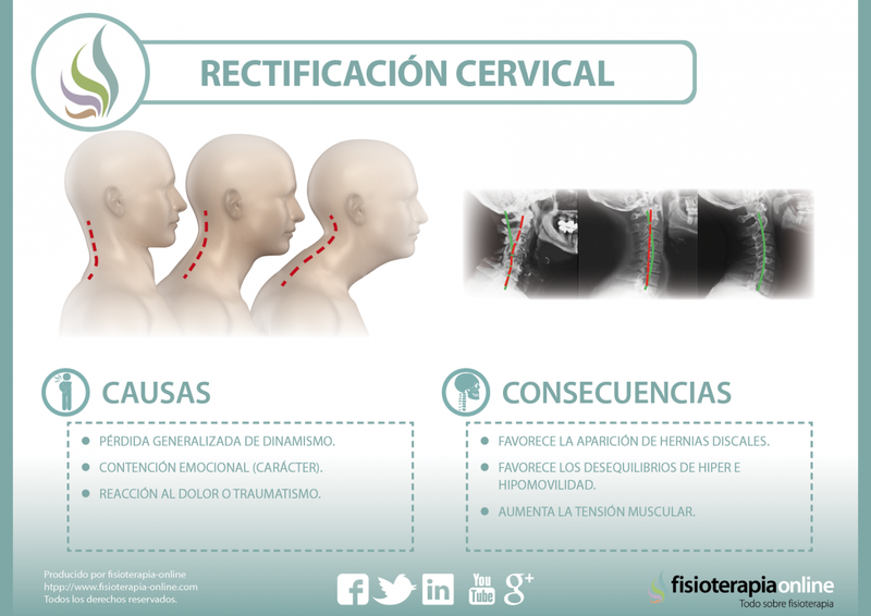 Archivo:Rectificacion cervical.png