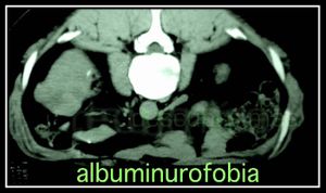 Albumirofobia.jpg
