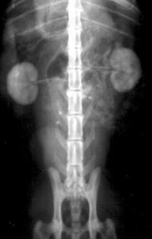 Urograma1.jpg