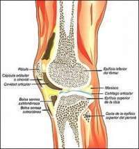 Fracturas bicondíleas.jpg