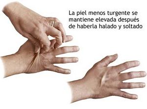 Tuegencia cutanea1.jpeg